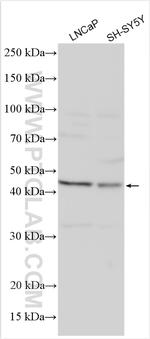 TREK1/KCNK2 Antibody in Western Blot (WB)