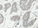 TP53RK Antibody in Immunohistochemistry (Paraffin) (IHC (P))