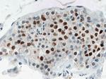 TP53RK Antibody in Immunohistochemistry (Paraffin) (IHC (P))