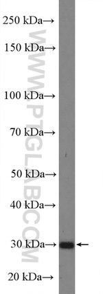 TP53RK Antibody in Western Blot (WB)