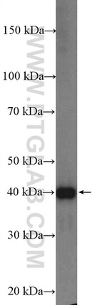 CPA4 Antibody in Western Blot (WB)