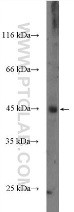 CPA4 Antibody in Western Blot (WB)