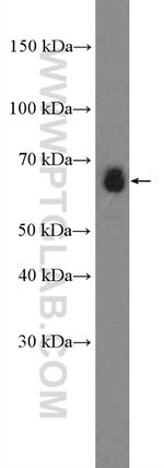 CstF-64 Antibody in Western Blot (WB)