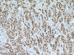 CstF-64 Antibody in Immunohistochemistry (Paraffin) (IHC (P))