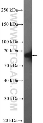 CstF-64 Antibody in Western Blot (WB)