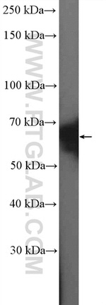 CstF-64 Antibody in Western Blot (WB)