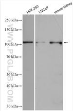 SLC12A9 Antibody in Western Blot (WB)