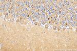SUSD4 Antibody in Immunohistochemistry (Paraffin) (IHC (P))