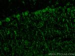 SUSD4 Antibody in Immunohistochemistry (PFA fixed) (IHC (PFA))