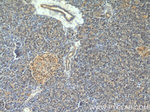 PLEKHA1 Antibody in Immunohistochemistry (Paraffin) (IHC (P))