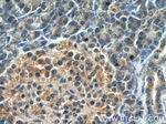 PLEKHA1 Antibody in Immunohistochemistry (Paraffin) (IHC (P))