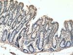PLEKHA1 Antibody in Immunohistochemistry (Paraffin) (IHC (P))