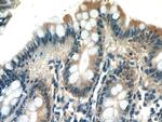 PLEKHA1 Antibody in Immunohistochemistry (Paraffin) (IHC (P))