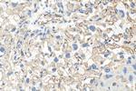 HAPLN1 Antibody in Immunohistochemistry (Paraffin) (IHC (P))