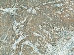 SLC22A16 Antibody in Immunohistochemistry (Paraffin) (IHC (P))