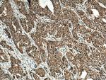 SLC22A16 Antibody in Immunohistochemistry (Paraffin) (IHC (P))
