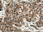 SLC22A16 Antibody in Immunohistochemistry (Paraffin) (IHC (P))