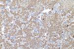 ACMSD Antibody in Immunohistochemistry (Paraffin) (IHC (P))