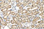 ACMSD Antibody in Immunohistochemistry (Paraffin) (IHC (P))