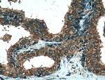 PLB1 Antibody in Immunohistochemistry (Paraffin) (IHC (P))