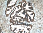 PLB1 Antibody in Immunohistochemistry (Paraffin) (IHC (P))
