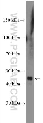 PLB1 Antibody in Western Blot (WB)