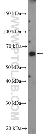FLVCR1 Antibody in Western Blot (WB)