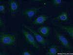 TRAF1 Antibody in Immunocytochemistry (ICC/IF)