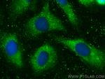 TIMP1 Antibody in Immunocytochemistry (ICC/IF)