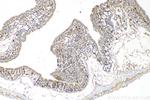 TIMP1 Antibody in Immunohistochemistry (Paraffin) (IHC (P))