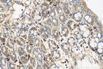 TIMP1 Antibody in Immunohistochemistry (Paraffin) (IHC (P))