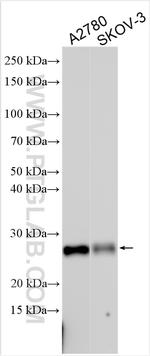 TIMP1 Antibody in Western Blot (WB)
