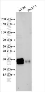 TIMP1 Antibody in Western Blot (WB)