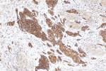 UPK1B Antibody in Immunohistochemistry (Paraffin) (IHC (P))