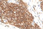 UPK1B Antibody in Immunohistochemistry (Paraffin) (IHC (P))