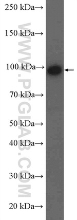 NOP14 Antibody in Western Blot (WB)