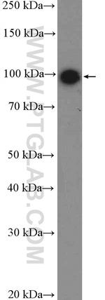 NOP14 Antibody in Western Blot (WB)