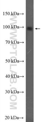 NOP14 Antibody in Western Blot (WB)