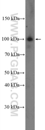 NOP14 Antibody in Western Blot (WB)