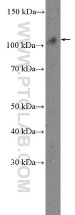 NOP14 Antibody in Western Blot (WB)