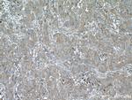 LTBP1 Antibody in Immunohistochemistry (Paraffin) (IHC (P))