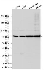 PTPRF Antibody in Western Blot (WB)