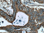 RAF1 Antibody in Immunohistochemistry (Paraffin) (IHC (P))