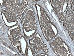 RAF1 Antibody in Immunohistochemistry (Paraffin) (IHC (P))