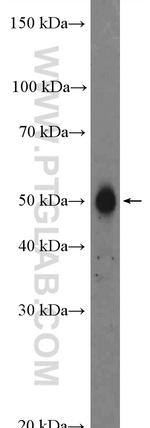 FAM175B Antibody in Western Blot (WB)