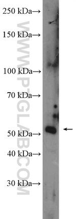 FAM175B Antibody in Western Blot (WB)