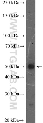 FAM175B Antibody in Western Blot (WB)