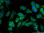 TIAM2 Antibody in Immunocytochemistry (ICC/IF)