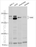 TIAM2 Antibody in Western Blot (WB)