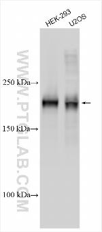 TIAM2 Antibody in Western Blot (WB)